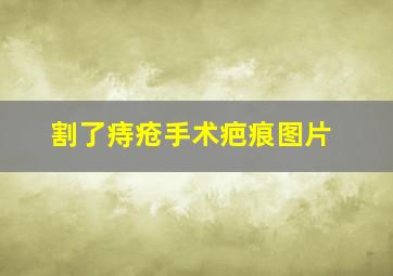 割了痔疮手术疤痕图片