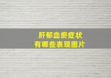 肝郁血瘀症状有哪些表现图片